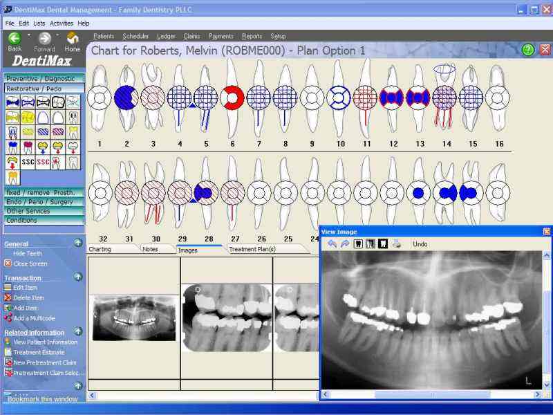 Dental Software Offline Installer Download